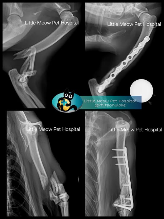 ภาพเอกซเรย์ก่อน-หลังผ่าตัดซ่อมกระดูก